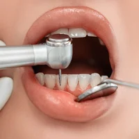 Лечение и эстетическая стоматология